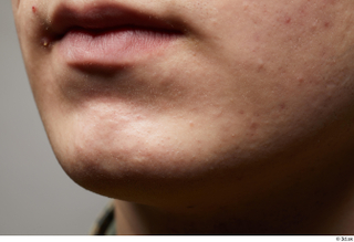 HD Face Skin Casey Schneider chin face lips mouth skin…